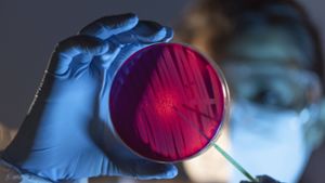 Experten zu Candida auris: „Pilzinfektionen sind unterschätzte Gefahr“