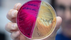 Detektivarbeit am Darm-Mikrobiom: Was Stuhlproben verraten