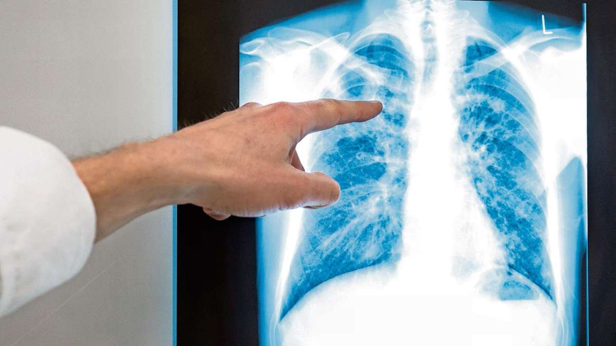 Thüringen: Ministerium gibt nach Tuberkulose-Todesfällen Entwarnung