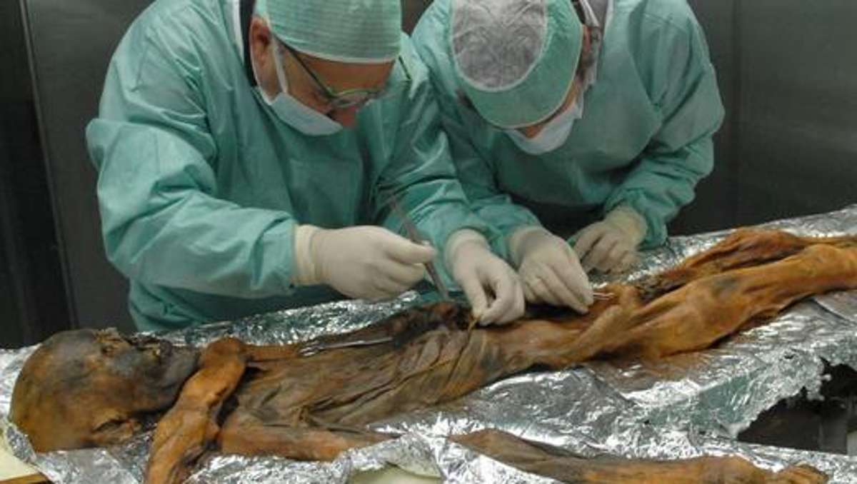 Thüringen: Ötzi war mit aggressivem Magenkeim infiziert
