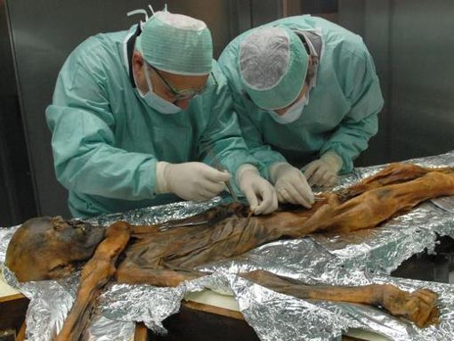 Die Wissenschaftler Eduard Egarter-Vigl (l) und Albert Zink untersuchen die rund 5000 Jahre alte Gletschermumie «Ötzi». Ötzi trug einen Keim, der für üble Bauchschmerzen gesorgt haben könnte. Foto: Marco Samadelli/EURAC/dpa/Archiv